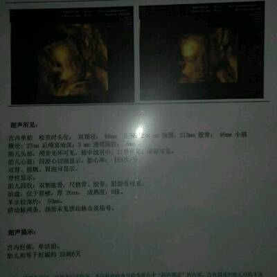 怎么做才能容易怀男孩,怎么备孕更容易怀男宝宝