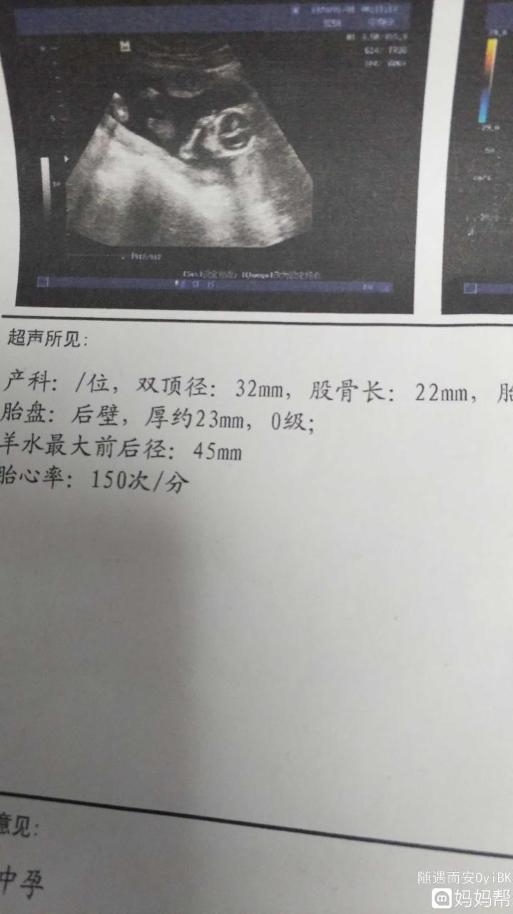 怎样怀男孩的几率更高,想生男孩要禁欲多久 *** 质量好