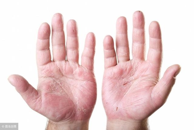 富贵手相的6种奇纹，真正大富大贵面相