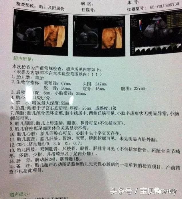 怎样怀男孩的几率更高,想生男孩要禁欲多久 *** 质量好