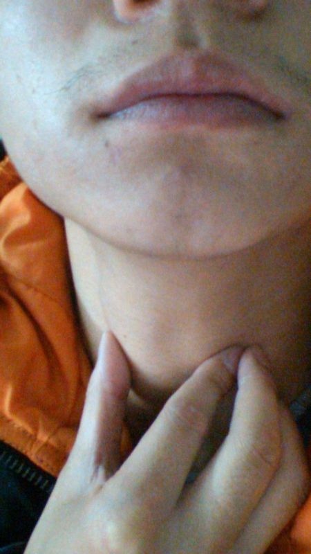 鼻腔干痛难受怎么办，鼻子里面 *** 辣疼干燥