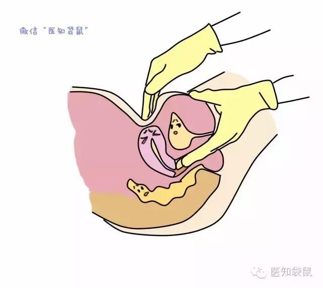 验血能查出来怀孕吗，验血hcg多少才算怀孕