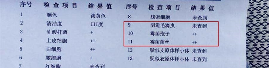 怎么看孕检血检报告单,血检报告单怎么看贫血