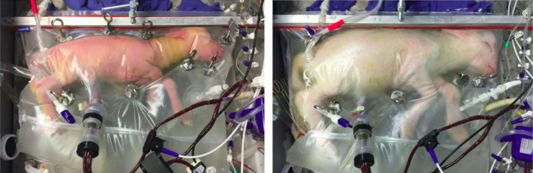 想生男孩人工受孕更好，人工受孕是自己的孩子吗