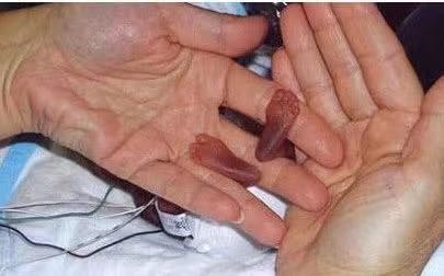 想生男孩人工受孕更好，人工受孕是自己的孩子吗