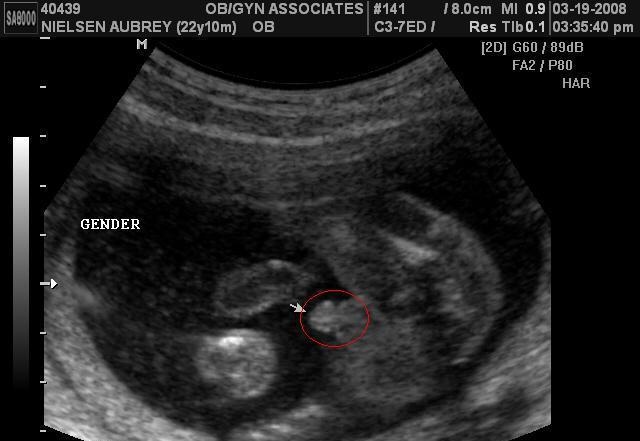 什么时候最容易怀儿子，七月容易坏男孩还是女孩