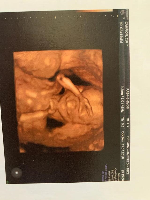 怀男孩很早就有感觉，初头男十头女