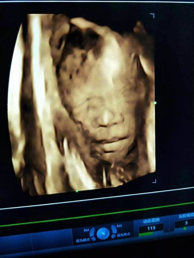 怀女孩的症状有哪些明显的症状，怀孕女孩的最准确症状有13个月