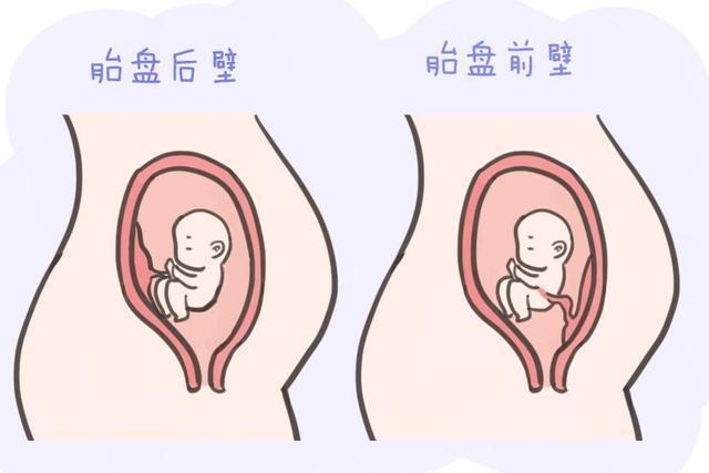 怀孕40天胸胀看男女，怀孕50天孕妇的状态