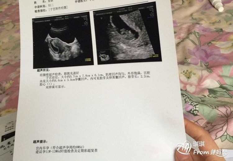 孕初期一招看男女,怀男孩很早就有感觉