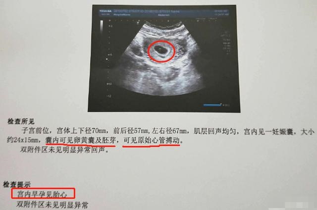怀孕40多天可以看出男女吗，九个最准怀男孩征兆