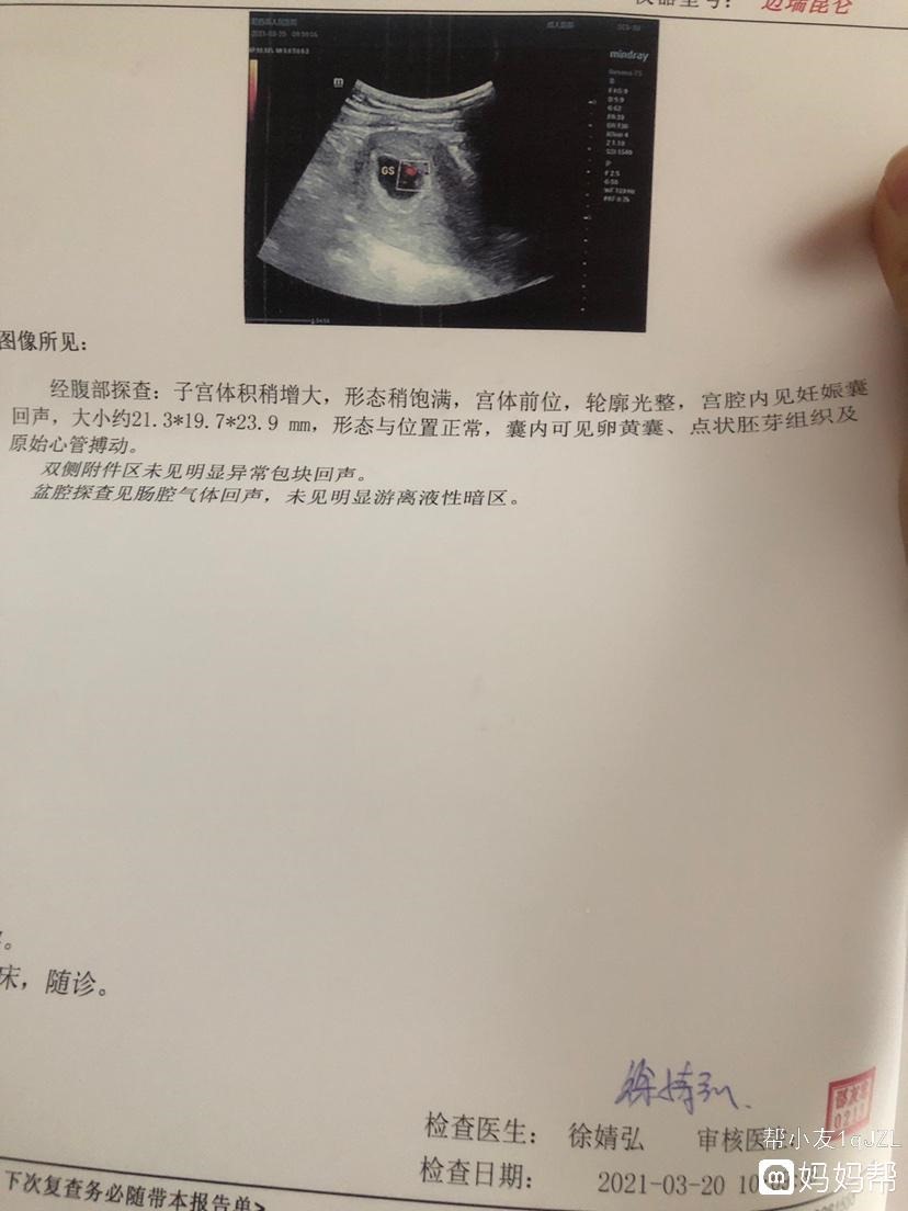 1月份怀孕预产期是什么时候，11月份怀孕容易生男孩还是女孩"