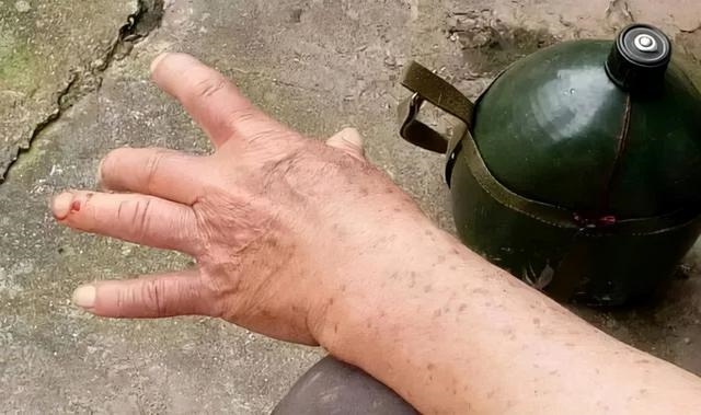 吃过蛇的人命都不好，发际线低的人命不好么