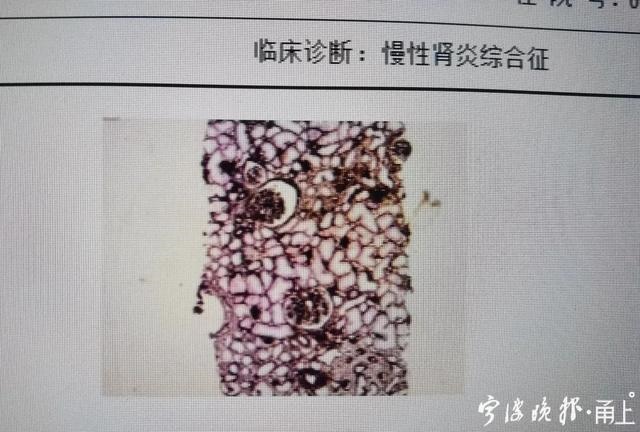 十蛇九苦的缘由，属蛇的女人太可怕了