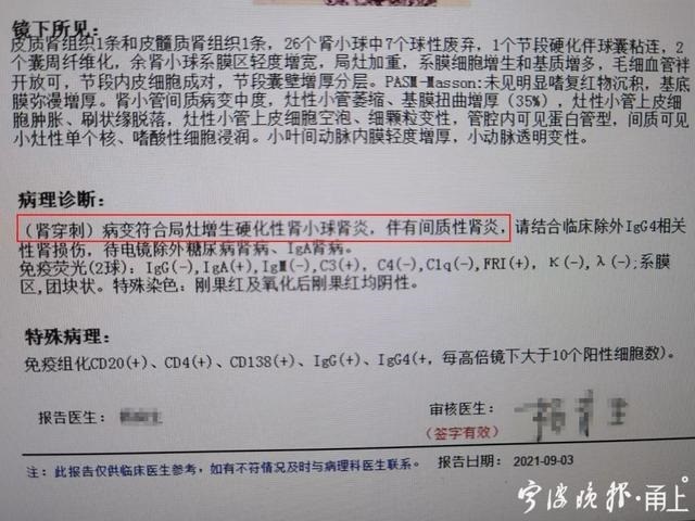 十蛇九苦的缘由，属蛇的女人太可怕了