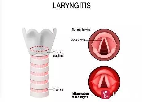 为什么33岁鬼门关，87年属兔33岁有一劫