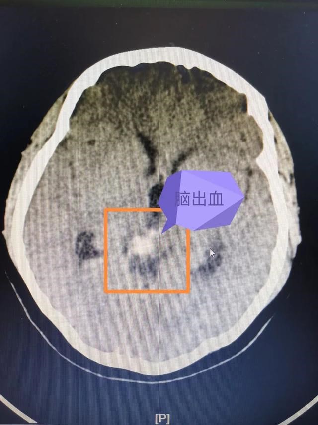 7岁开始转运，带上转运珠发表说说"