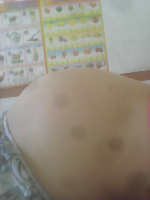 2、平躺下看男女,很准哟:B超看男女，有多少个翻盘的？进来验证一下。