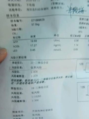 3、无创DNA检测，可以看孩子性别吗？据说 21,18,13 这三个值之间，18的值比21和13都低，就是反之女宝！