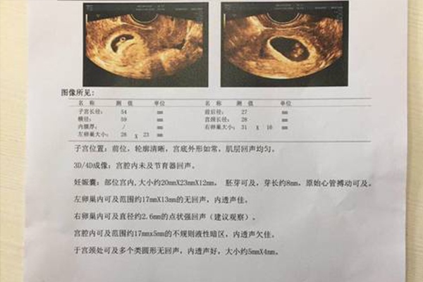 2、怀孕9周+孕囊大小为57*52*39顶臀径，请问男孩还是女孩？