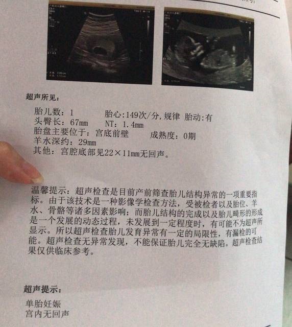 2、虎年生女孩多还是男孩多:虎年生儿子多还是女儿多？