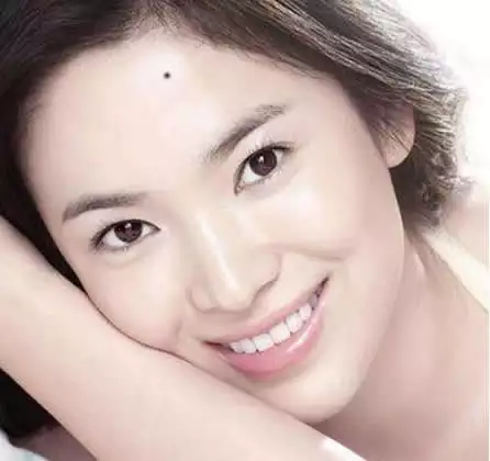 3、女人脸上有哪些痣，注定富贵伴一生？