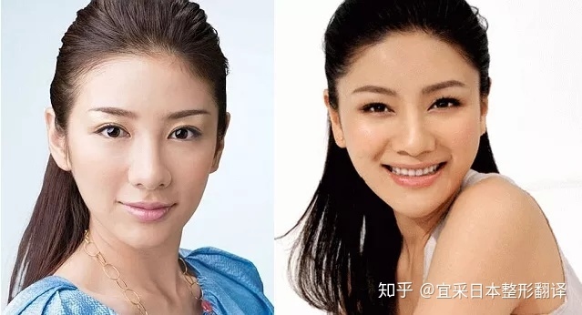 2、蒜头鼻但长得漂亮的人