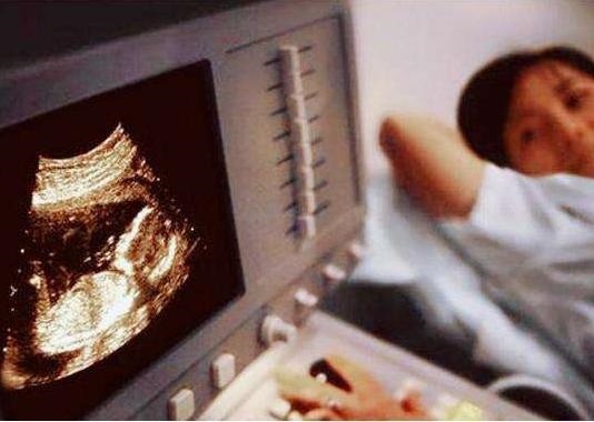 2、产科医生的哪些有意思的套词，可能暗示胎儿性别？