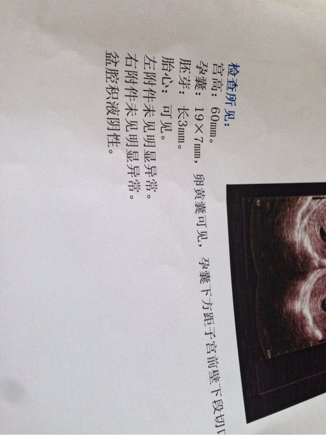 2、怀女孩有什么特征反应