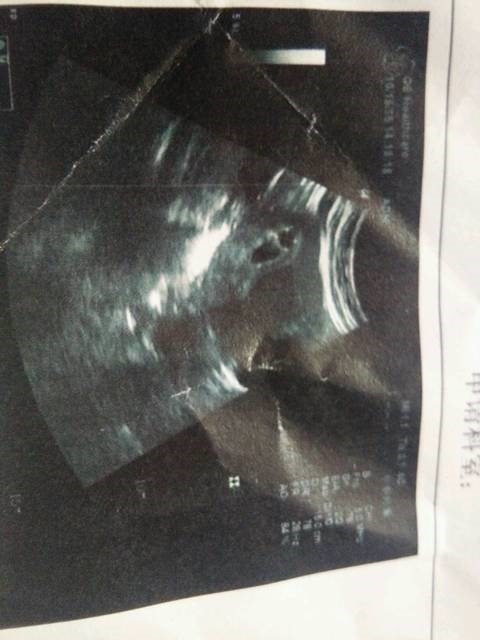 2、怀是什么感觉？