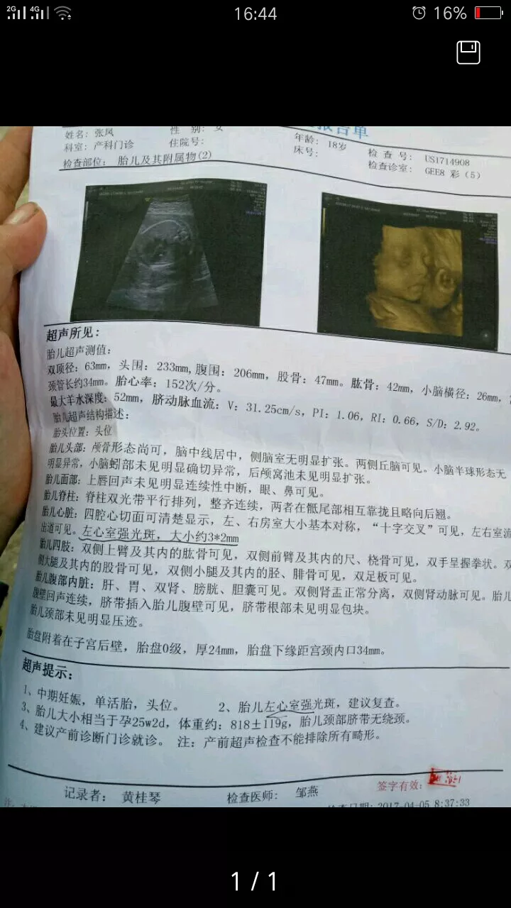 3、四维单子上男孩标志是什么意思？