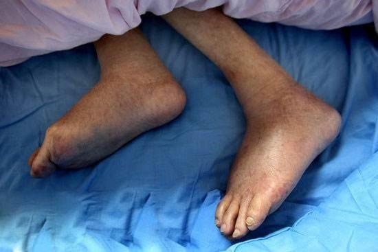 2、老人临终前有什么表现