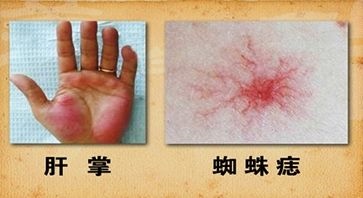 2、怎样保养？不好的症状？
