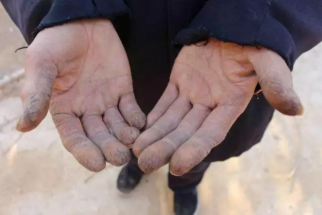 3、为什么中国人在临终之间总希望能与子女见到**一面. 很重要吗??