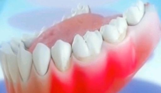 2、牙科医生总是建议洗牙，洗牙真的很重要么？