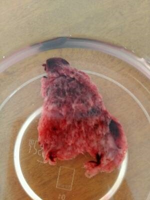 2、人流和药流那个比较痛苦？？？