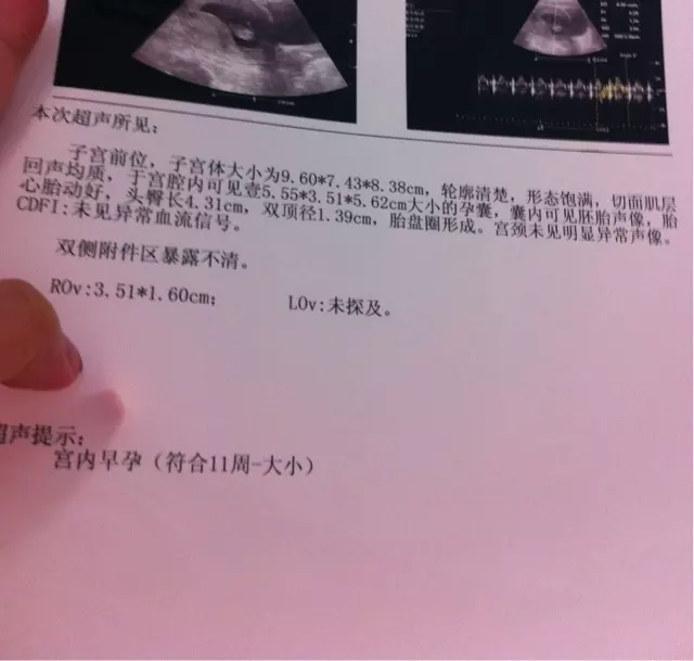 3、胎囊3个数据看男女公式哪里可以找到？