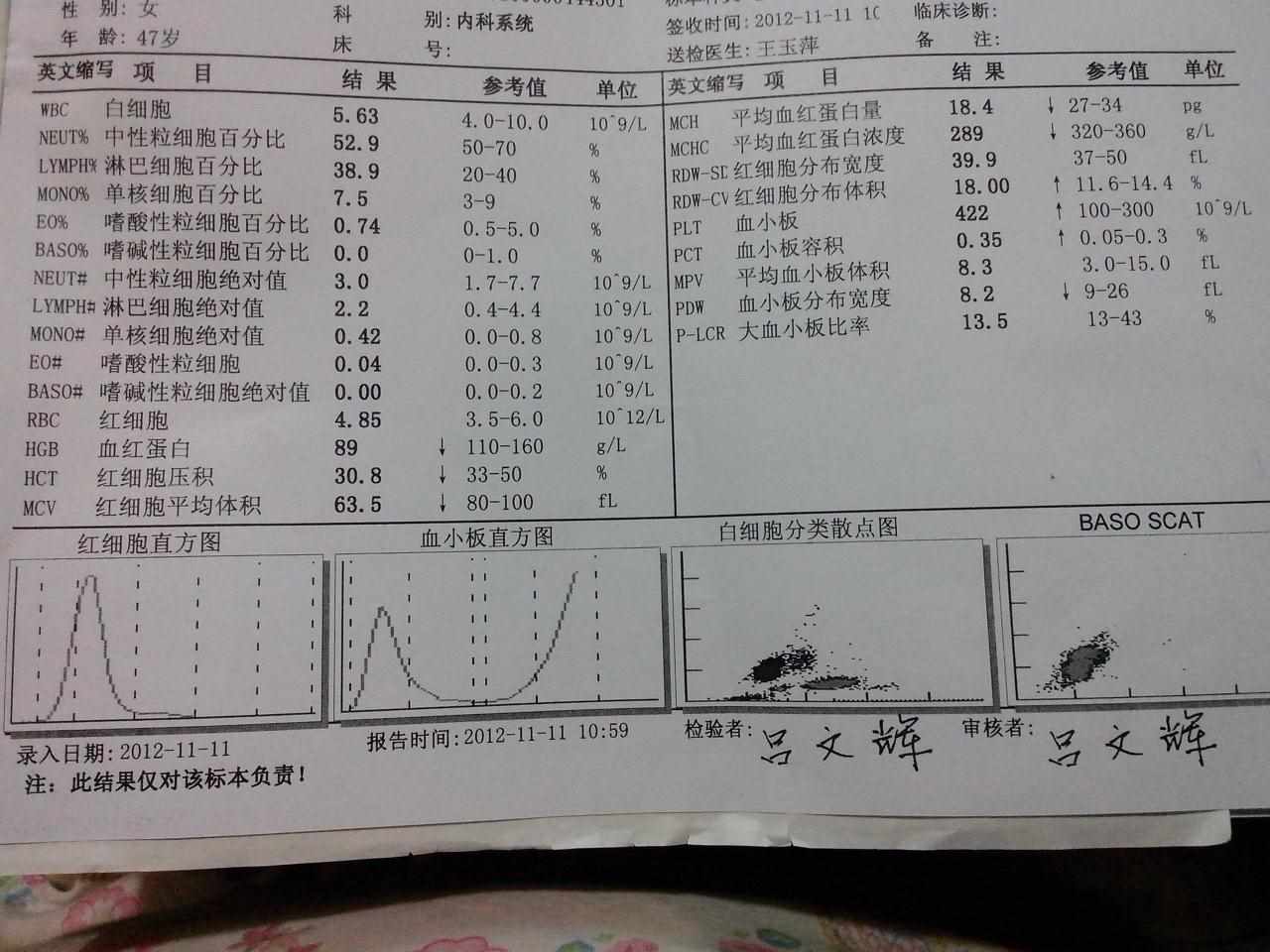 2、55天的孕囊回声约男孩还是女孩