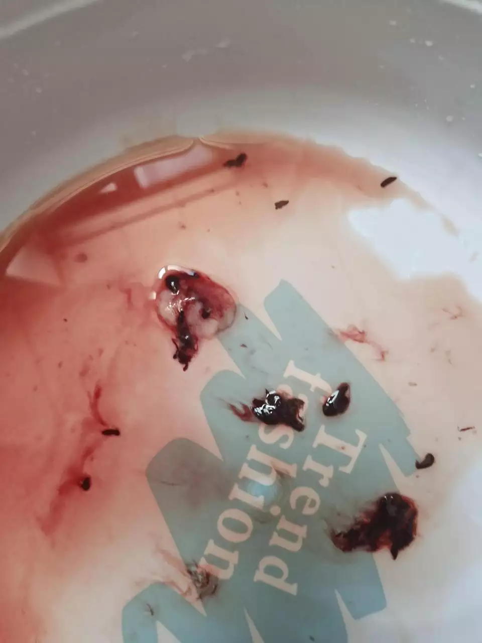 3、35天的孕囊流下来的图片