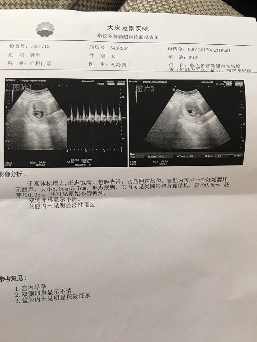 2、我的这个孕囊只有两个数字，能看男女吗？