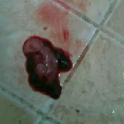 4、药流最完整的图片是？