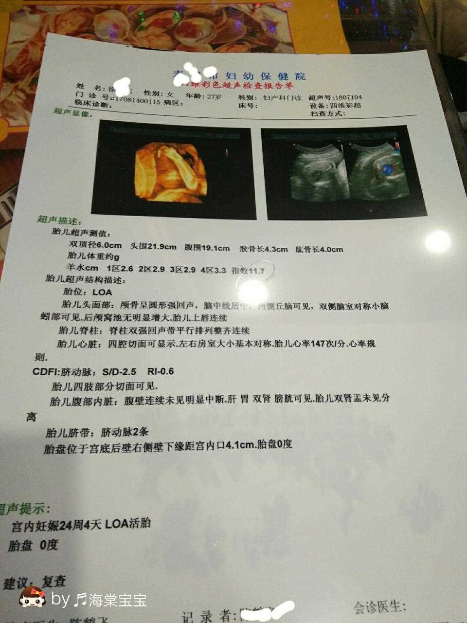 2、胎宝宝的四维彩超照片很丑，是不是出生后也会很丑？