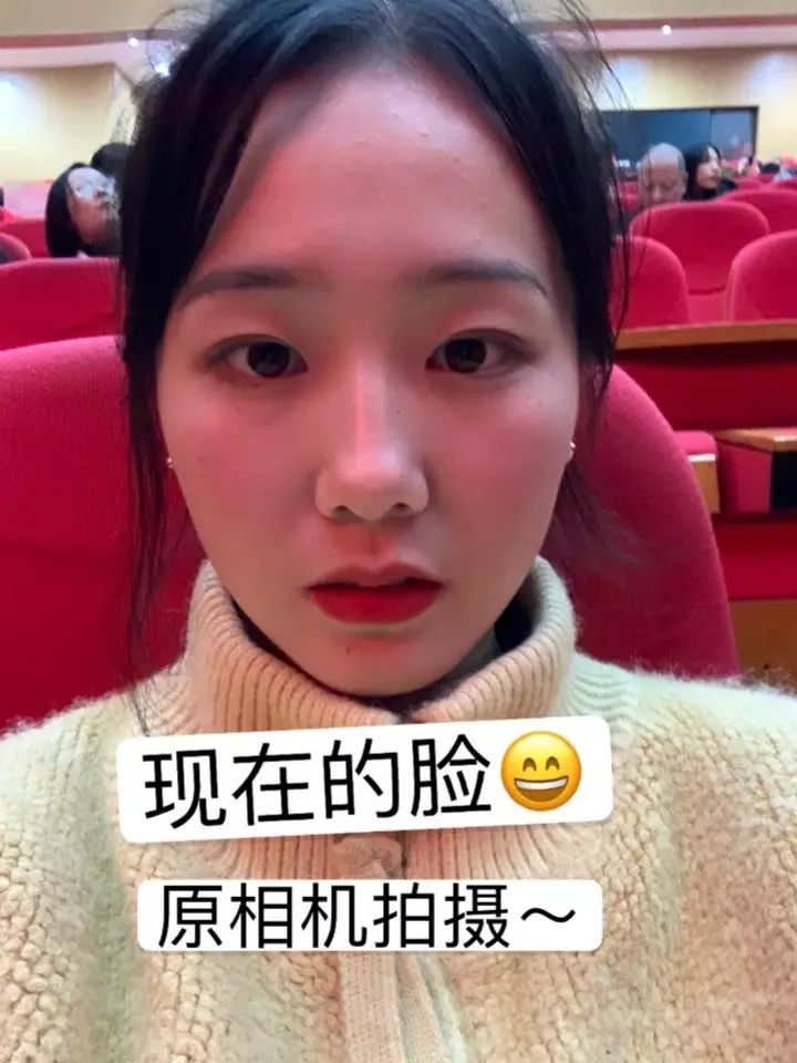 3、为什么照镜子脸不歪，拍照就嘴歪脸斜了，好丑好难看，都不敢和朋友们合影照相了，该怎么办才好？