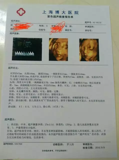 3、四维单子可以看出男孩女孩吗？