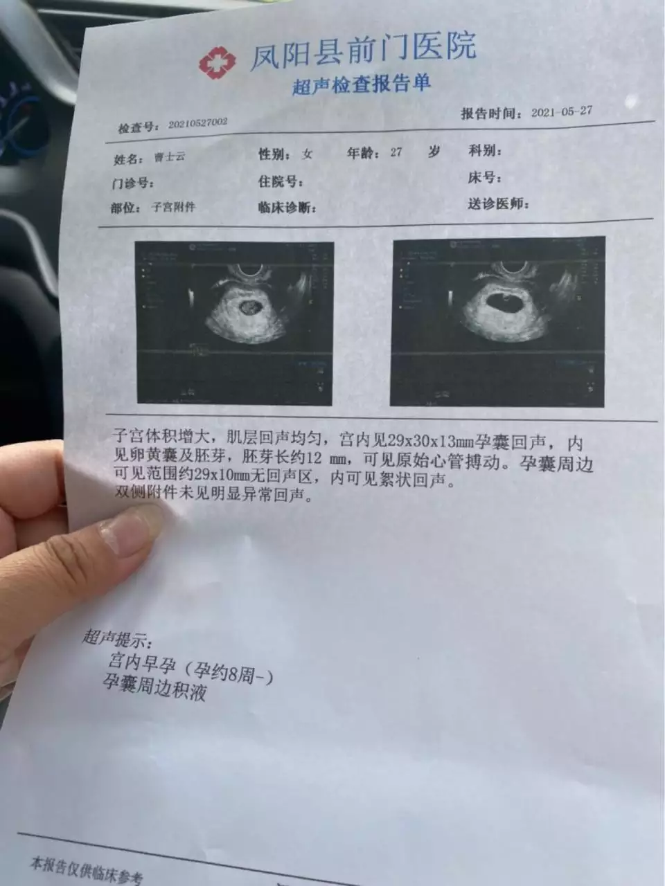 4、看孕囊数据大小能看出男女吗