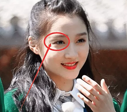 3、关晓彤脸上的痣为什么不去掉