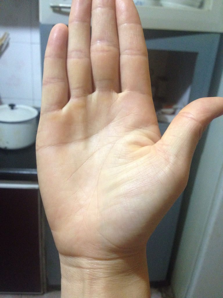 2、手掌发红是什么原因啊？谢谢！