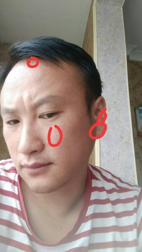 2、懂的进来说说图片上的痣是福痣吗?福痣通常长在哪里?脸上的都算。