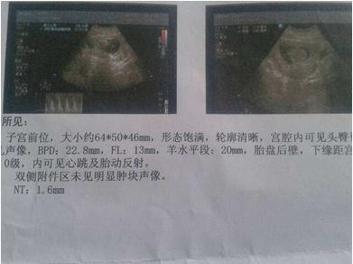 2、我有一个很准生男生女