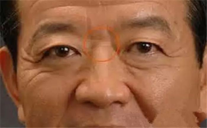 3、我儿子脑门磕坏了算是破相吗?破相有啥说法吗